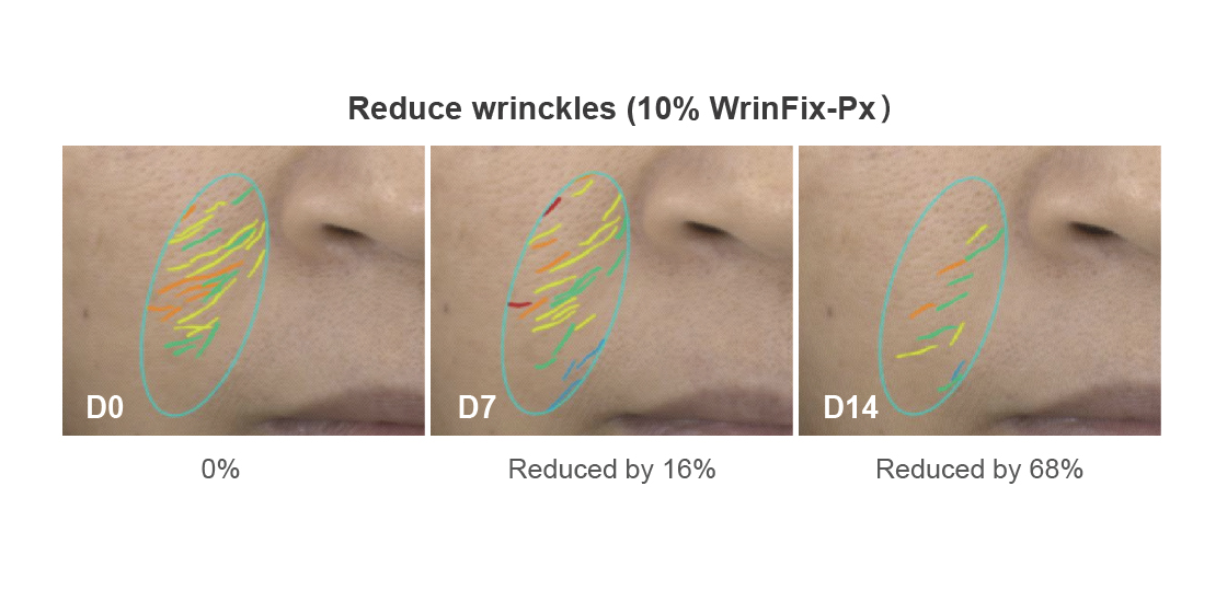 WrinFix-Px